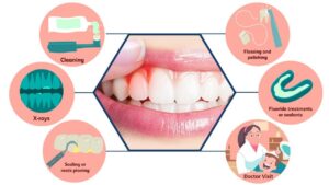 Gingivitis Prevention