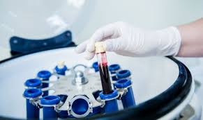 Plasma Rich Growth Factor (PRGF)
