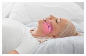 Snoring Treatment