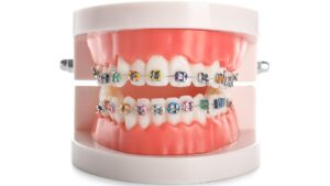 Orthodontics