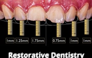Restorative Dentistry